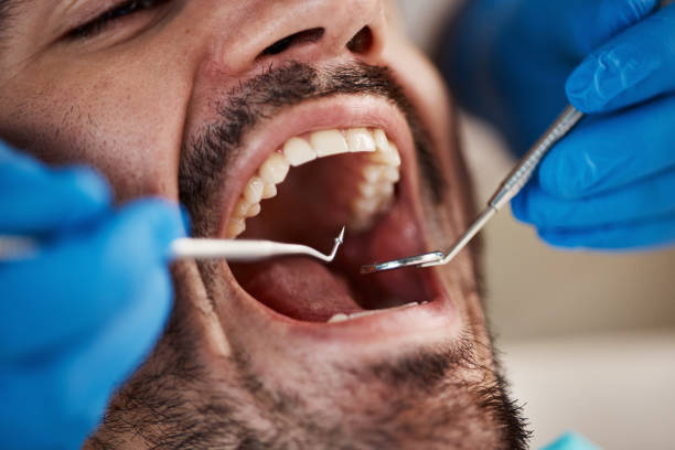 Oral Surgery in Concord, AL